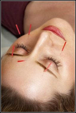 acupuncture on the face